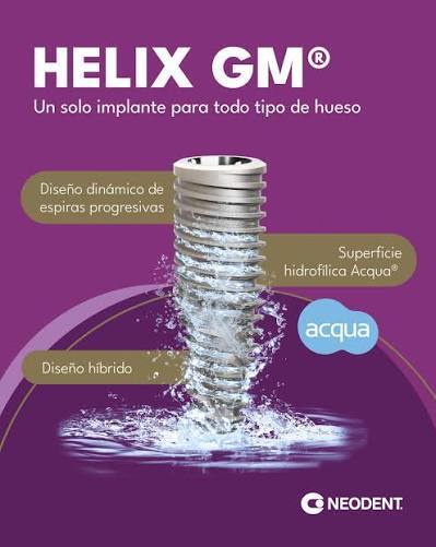Implante Neodent Helix Grand Morse con superficie Acqua